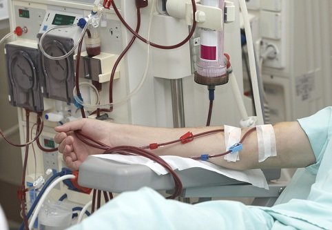 Дитячий діаліз: заощаджені 14,5 млн грн підуть на дозакупівлі медикаментів та виробів медичного призначення