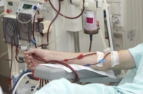 Дитячий діаліз: заощаджені 14,5 млн грн підуть на дозакупівлі медикаментів та виробів медичного призначення