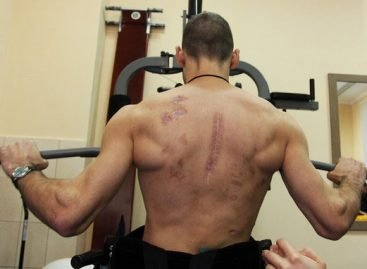 “Родина – це добрий лікар для бійця, який повернувся з війни з інвалідністю”