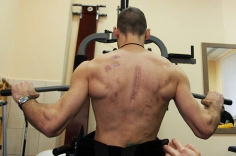 “Родина – це добрий лікар для бійця, який повернувся з війни з інвалідністю”