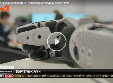 Унікальний 3D протез шотландські радійники подарували на Різдво хлопчику з інвалідністю