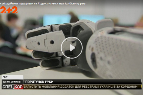 Унікальний 3D протез шотландські радійники подарували на Різдво хлопчику з інвалідністю