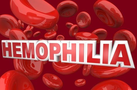 17 квітня — Всесвітній день боротьби з гемофілією