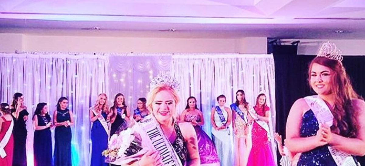 Вперше в історії. Модель з синдромом Дауна перемогла в конкурсі краси