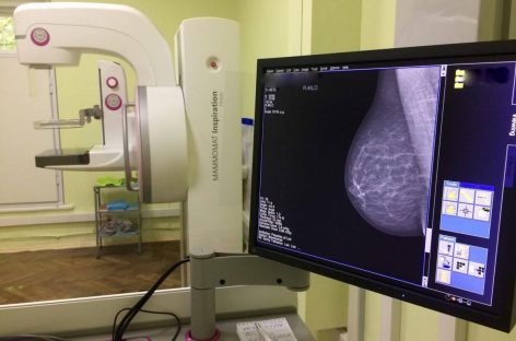 Як налагодили систему раннього виявлення онокозахворювань у жінок на Львівщині