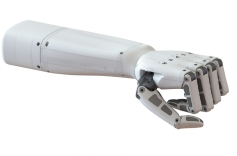 Біонічний протез проєкту Esper Bionics