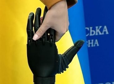 Винахідник із Кривого Рогу розробив біонічний протез