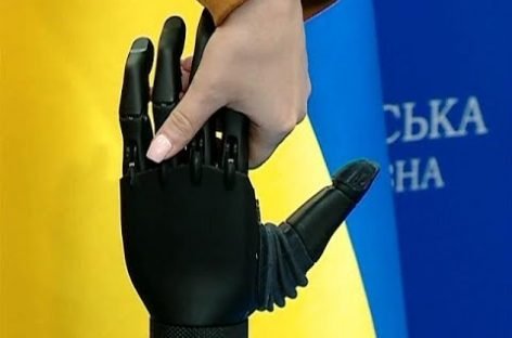 Винахідник із Кривого Рогу розробив біонічний протез
