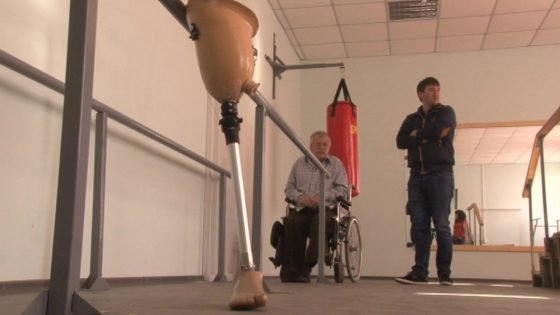 У Черкаському протезно-ортопедичному цеху відкрили реабілітаційну кімнату