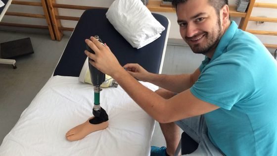 Новый нейропротез ноги воспринимается центральной нервной системой пользователя в качестве продолжения конечности