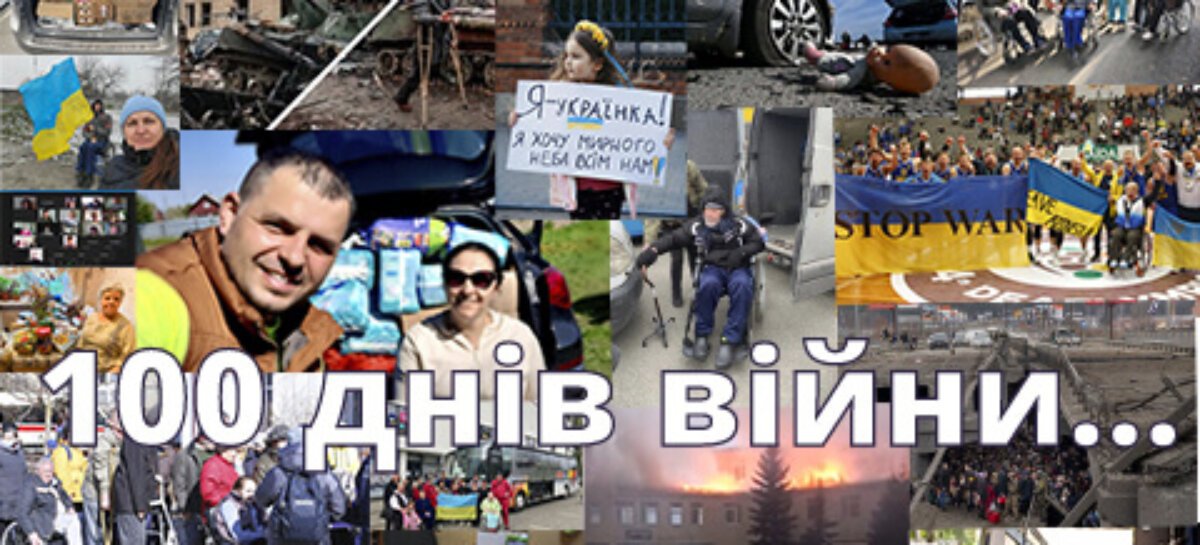 100 днів війни…