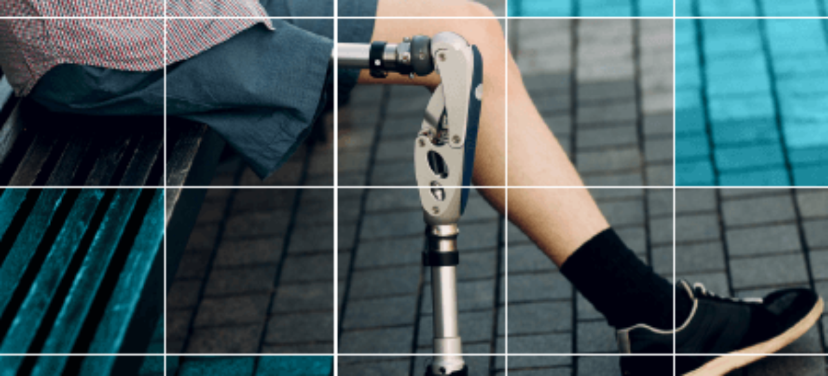 Буклет “Забезпечення асистивними технологіями” / PROVISION WITH ASSISTIVE TECHNOLOGIES